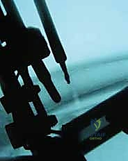 تركيب أسلاك وحلقات المثبت الخارجي