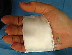 Orthopedic Prometric MCQs - Chapter 4 Part 8