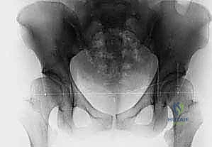 تطبيق العلاج التحفظي ومتابعته