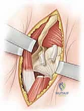 التقييم الشامل للمفصل بعد الرد