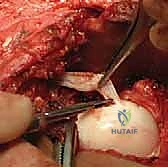 استخدام التصوير الطبي المتقدم في تقييم الورك