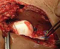 التأكيد الإشعاعي داخل غرفة العمليات