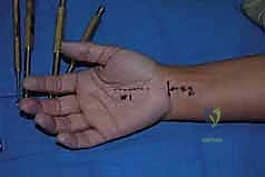 Clinical Image