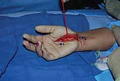 Clinical Image
