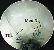 Clinical Image