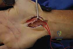 Clinical Image