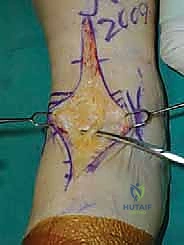 التشريح العظمي لمفصل الكاحل