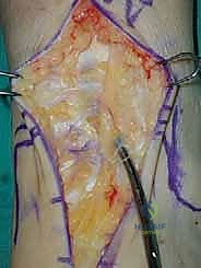 تقييم حالة المريض قبل الجراحة