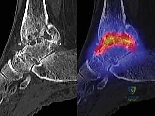 استخدام الأدوات الجراحية الدقيقة