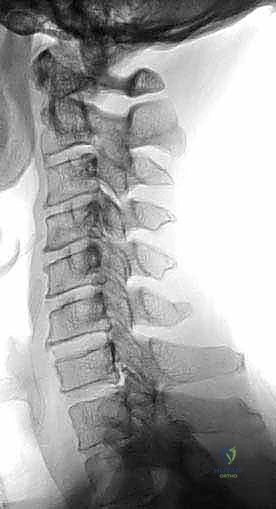 شرح أسباب اختيار النهج الجراحي الأمامي