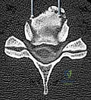 أجهزة التشخيص المتقدمة لتقييم حالة العمود الفقري