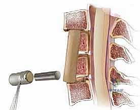 جلسات العلاج الطبيعي والتأهيل الحركي