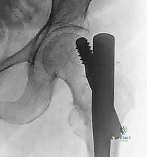 Clinical Image