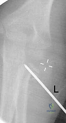 Clinical Image
