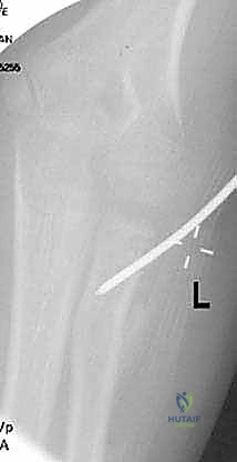 Clinical Image