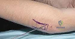 Clinical Image