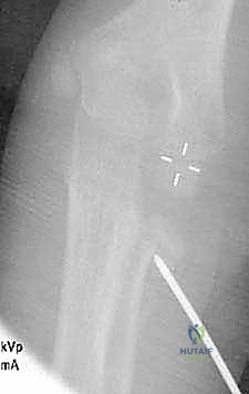 Clinical Image