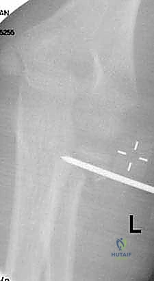 Clinical Image