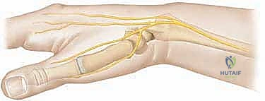 Clinical Image