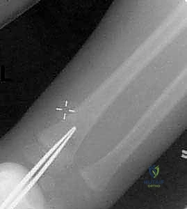 Clinical Image