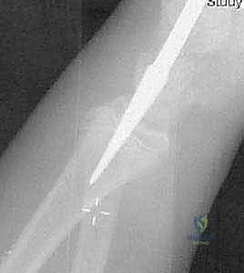 Clinical Image