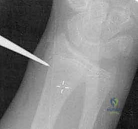 Clinical Image
