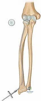 Clinical Image