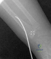 Clinical Image
