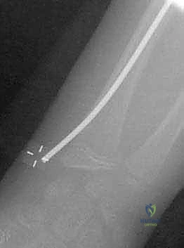 Clinical Image