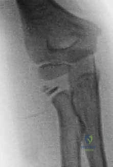 Clinical Image