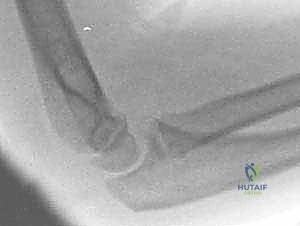 Clinical Image