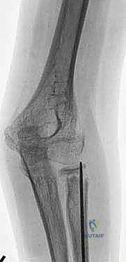 Clinical Image