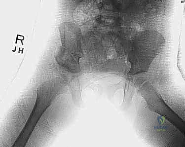 Clinical Image