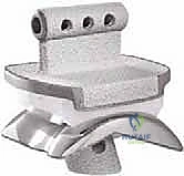 صورة طبية: استبدال مفصل الكاحل الكلي بنظامي سالتو وسالتو تالاريس: دليل شامل من الأستاذ الدكتور محمد هطيف