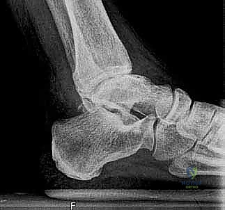 الدكتور محمد هطيف أثناء الجراحة