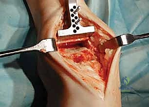 استخدام تقنيات 4K في الجراحة