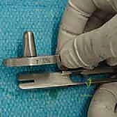 صورة طبية: استبدال مفصل الكاحل الكلي: استعادة الحركة والتخلص من الألم مع الأستاذ الدكتور محمد هطيف