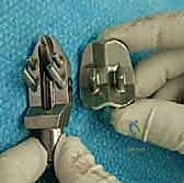 صورة طبية: استبدال مفصل الكاحل الكلي: استعادة الحركة والتخلص من الألم مع الأستاذ الدكتور محمد هطيف