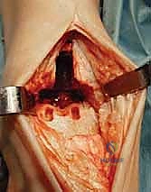 العلاج الطبيعي للكاحل