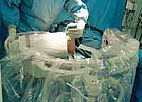 صورة توضيحية لـ استبدال مفصل الكاحل الكلي: استعادة الحركة والتخلص من الألم مع الأستاذ الدكتور محمد هطيف