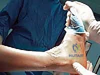 صورة طبية: استبدال مفصل الكاحل الكلي: استعادة الحركة والتخلص من الألم مع الأستاذ الدكتور محمد هطيف