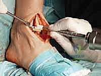 تمارين مدى الحركة