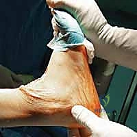 الفحص السريري للكاحل