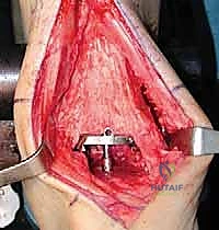 متابعة حالة المريض الدورية في عيادة الدكتور محمد هطيف