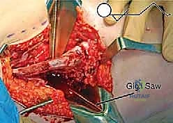 الأستاذ الدكتور محمد هطيف في غرفة العمليات