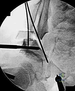 متابعة المريض في العيادة بعد 6 أشهر