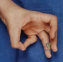 Clinical Image