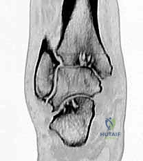 التحقق من زوايا القطع بالأشعة المباشرة