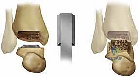 استخدام الأشعة المقطعية في التخطيط الجراحي