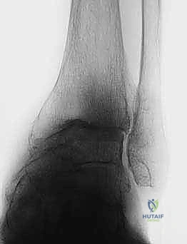 تعقيم وتجهيز المريض في غرفة العمليات
